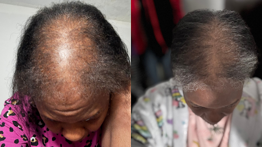 Before and after result