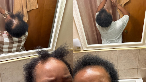Before and after result
